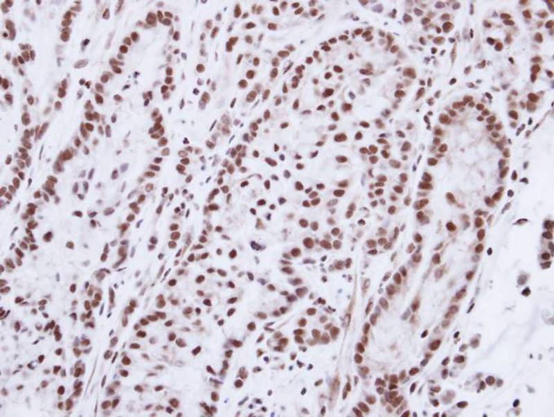 Progesterone receptor antibody