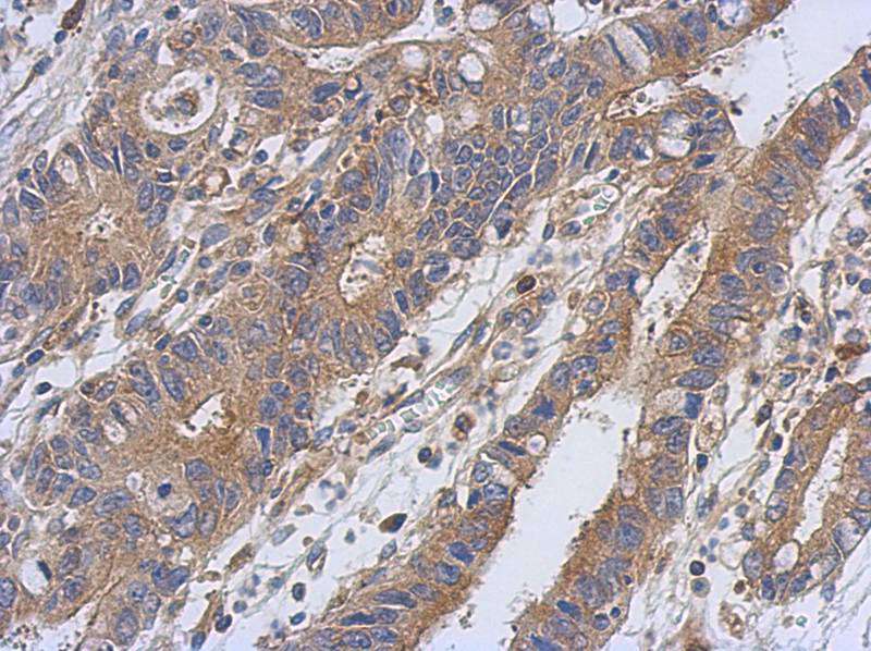 PKC antibody