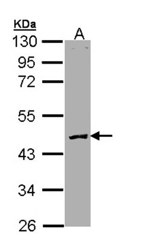 Protein C antibody