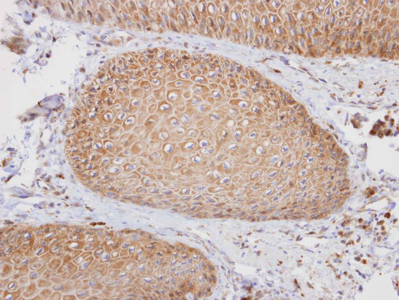 PTGFRN antibody