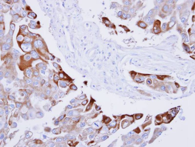 RAC1 antibody