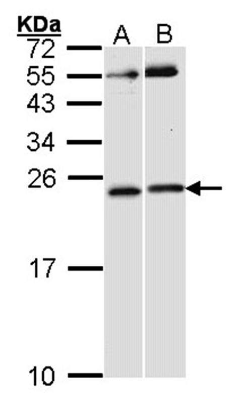 RAC1 antibody