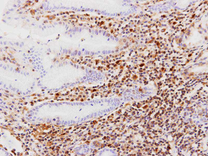 RAR-gamma antibody