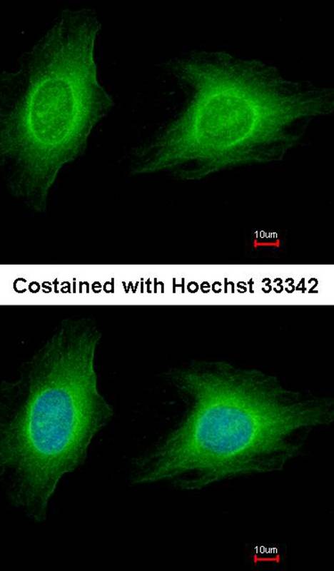 ROCK1 antibody