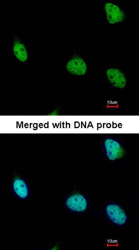 RSK1 p90 antibody