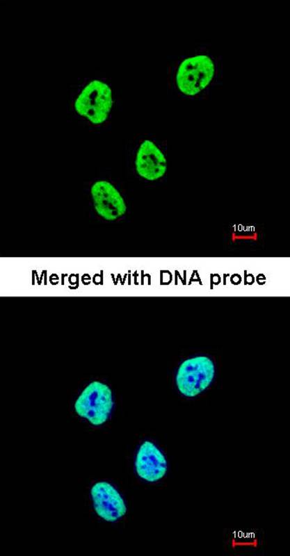 SET antibody