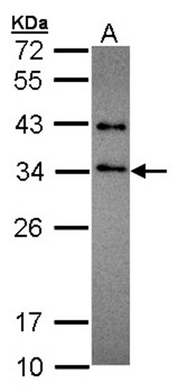 SET antibody