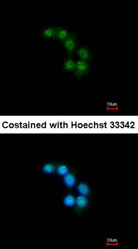 Unc18-2 antibody