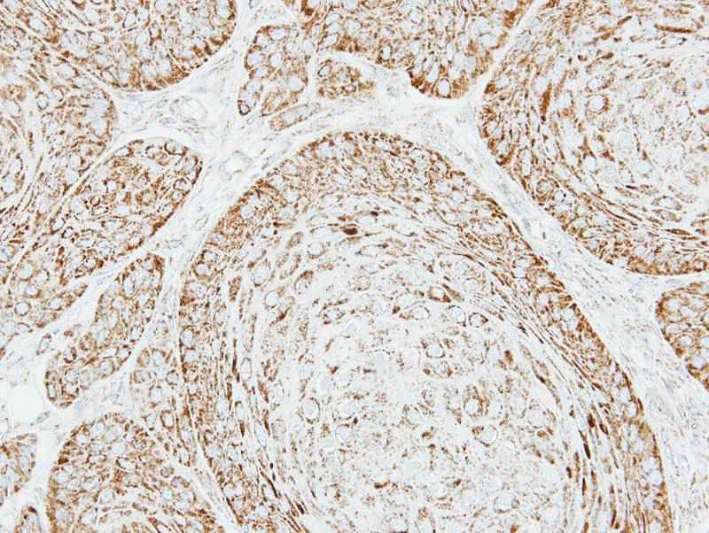 VDAC1 antibody