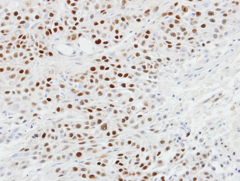 p63 antibody