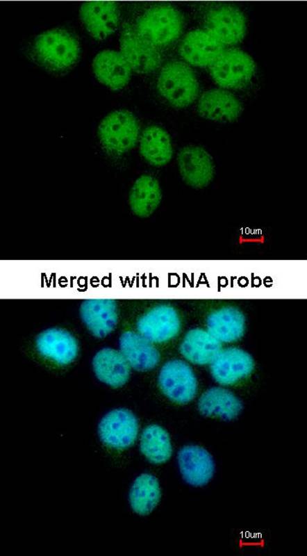 p63 antibody