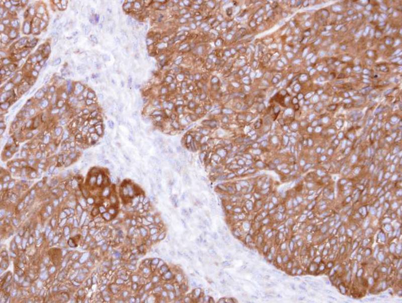 MIPP antibody