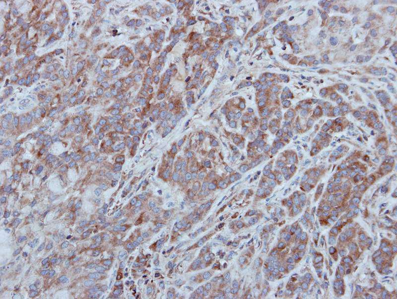 UNC13(C. elegans)-like antibody