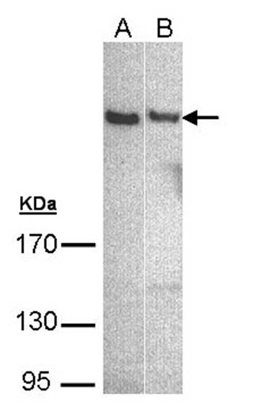 phospholipase C eta 1 isoform b antibody