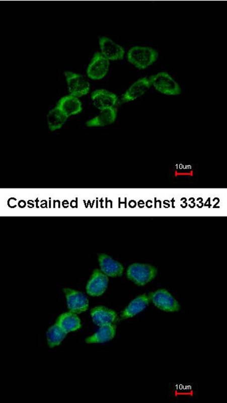 DDAH1 antibody