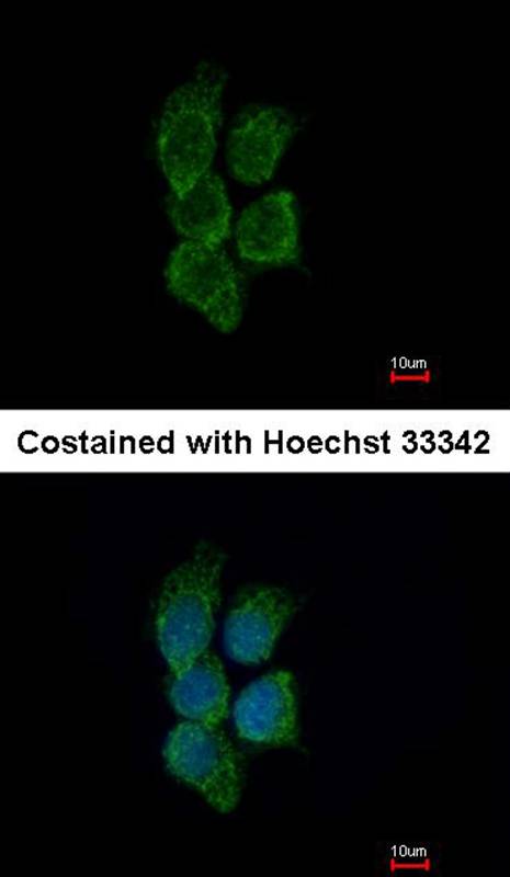GALNT7 antibody