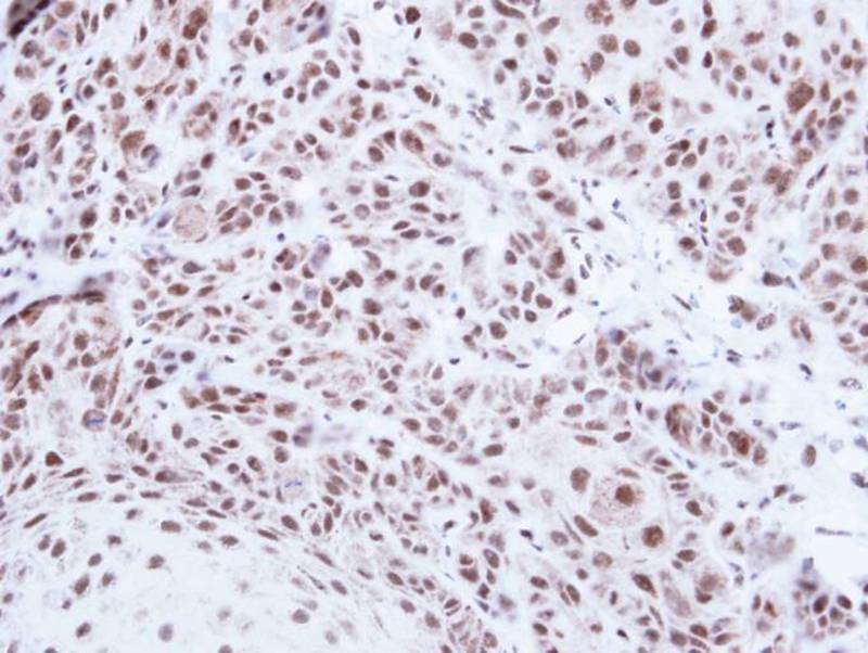 PRPF39 antibody