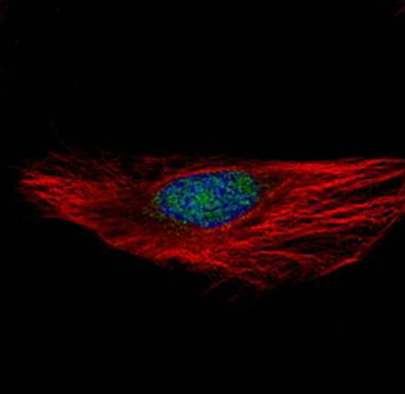 RNA binding motif protein 28 antibody
