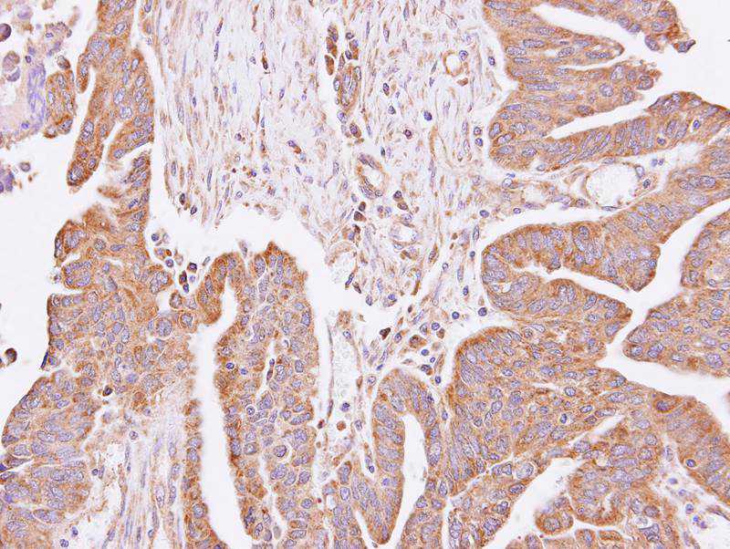 hypothetical protein LOC55286 antibody
