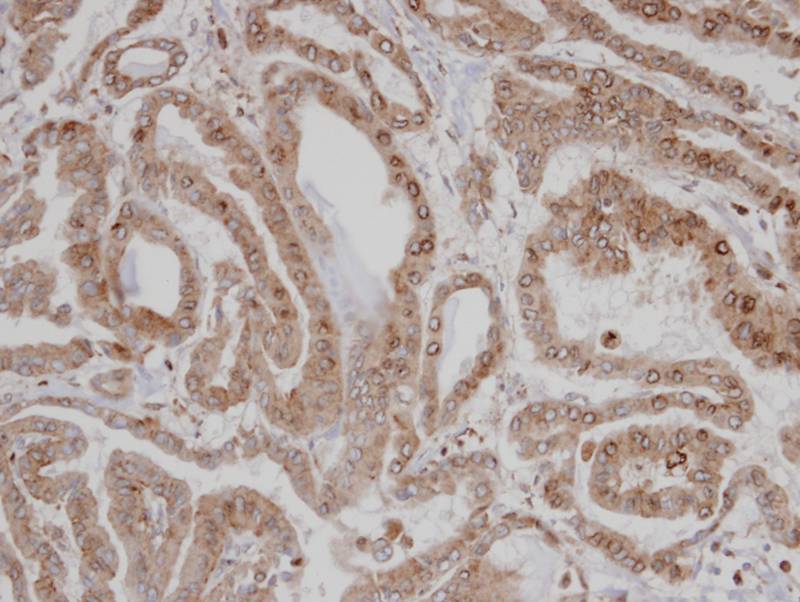 CAMK1D antibody
