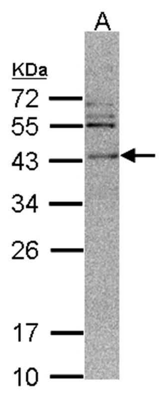 CAMK1D antibody