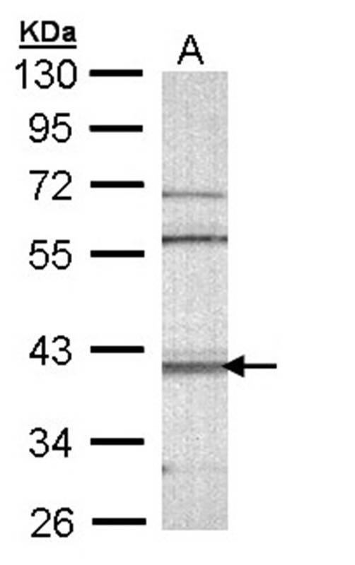 CAMK1D antibody
