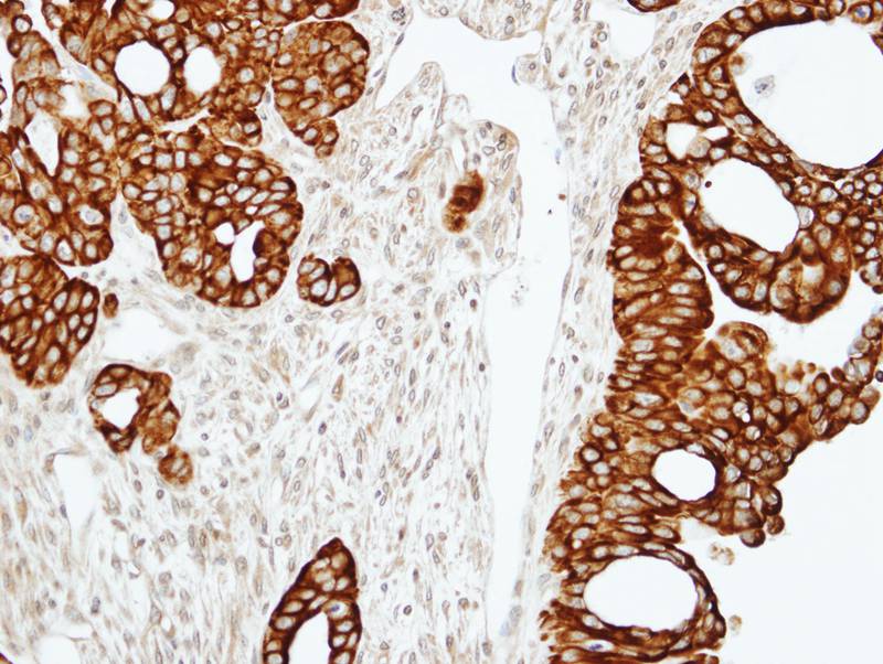 RAP2C antibody
