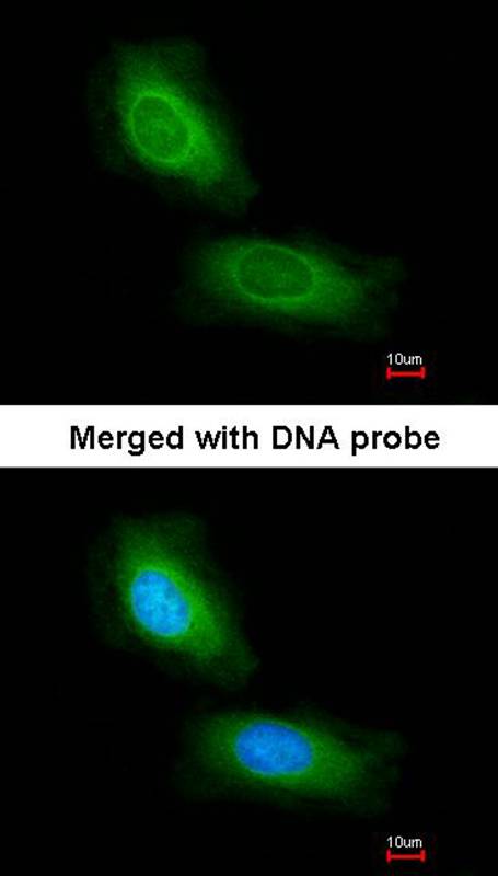 CCDC68 antibody