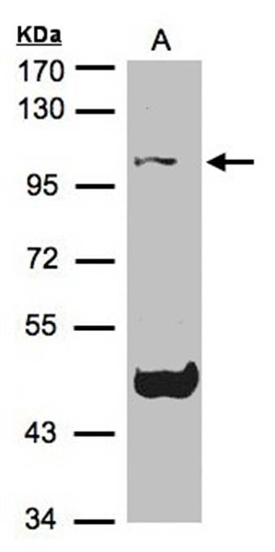 Cryopyrin antibody
