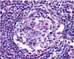 CCR5 Antibody