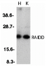 RAIDD Antibody