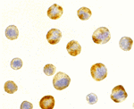RAIDD Antibody