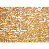 TIRAP Antibody