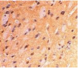 APP Antibody