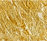BACE2 Antibody