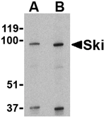 Ski Antibody