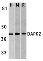 DAPK2 Antibody