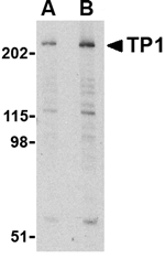 TP1 Antibody