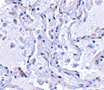 TP1 Antibody