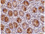 AATF Antibody