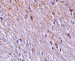 TTC5 Antibody