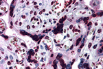 CARMA2 Antibody