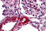CARMA3 Antibody