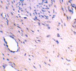 ARMER Antibody