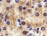ST2 Antibody