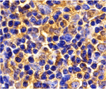 UBC13 Antibody