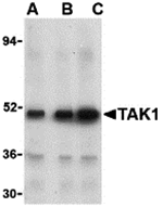 TAK1 Antibody