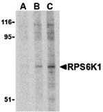 RPS6K1 Antibody