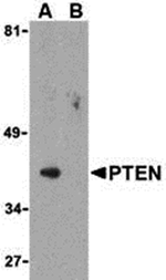 PTEN Antibody
