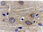 Adiponectin Antibody